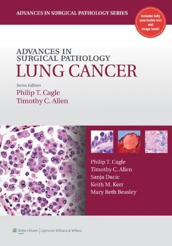 Advanced Surgical Pathology Lung Cancer - 1st Edition