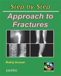 Step by Step Approach to Fractures with Cd-rom - 1st Edition