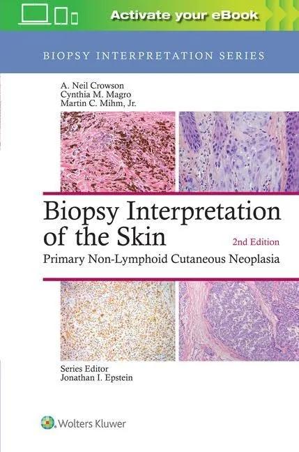 Biopsy Interpretation of the Skin - 2nd Edition