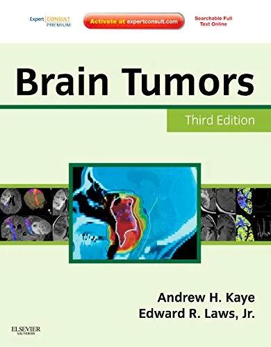 Brain Tumors An Encyclopedic Approach Expert Consult - Third Edition