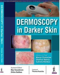 DERMOSCOPY IN DARKER SKIN