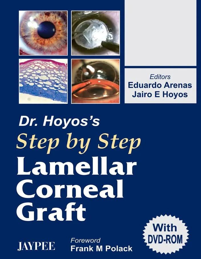 Dr.hoyos Step by Step Lamellar Corneal Graft - 1st Edition