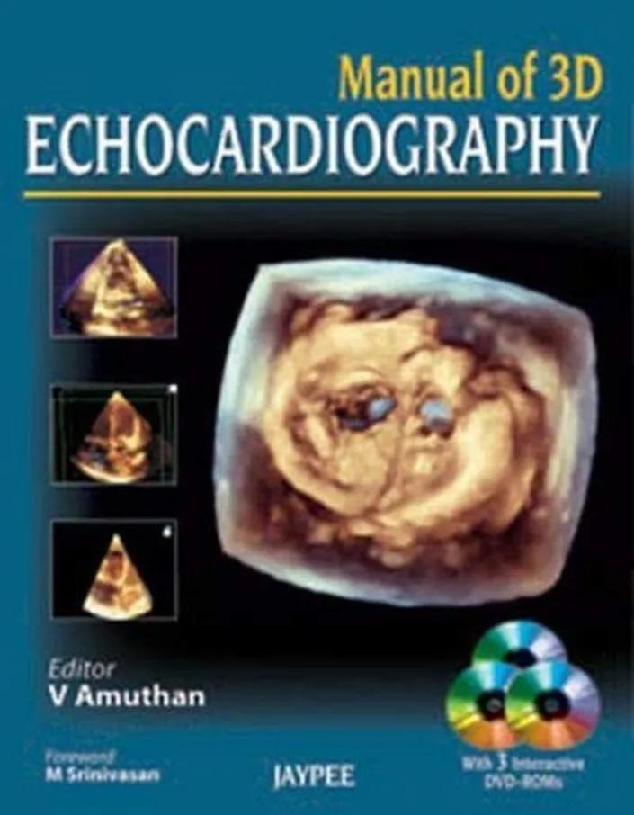 Manual of 3d Echocardiography - 1st Edition