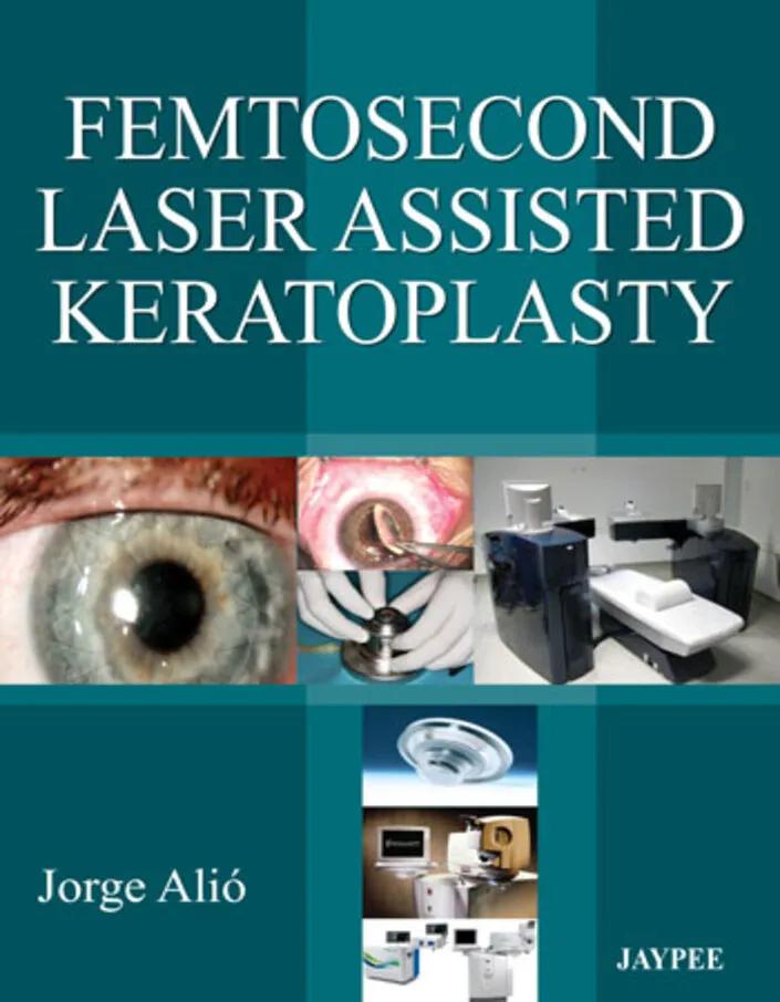 Femtosecond Laser Assisted Keratoplasty - 1st Edition