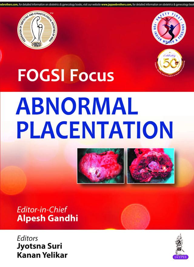 Fogsi Focus Abnormal Placentation - 1st Edition