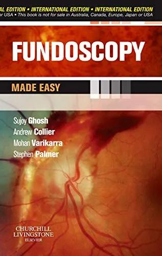 Fundoscopy Made Easy - 1st Edition