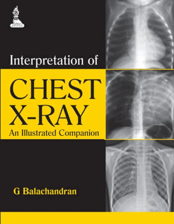 Interpretation of Chest X-ray an Illustrated Companion - 1st Edition