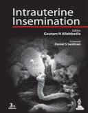 Image of Intrauterine Insemination - Third Edition