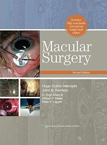 Macular Surgery - 2nd Edition