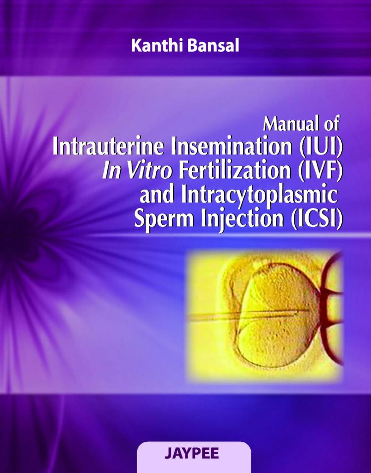 Manual Of Intrauterine Insemination(iui)in Vitro Fertilization(ivf)andintracytoplasmic Sperm Inj.(icsi