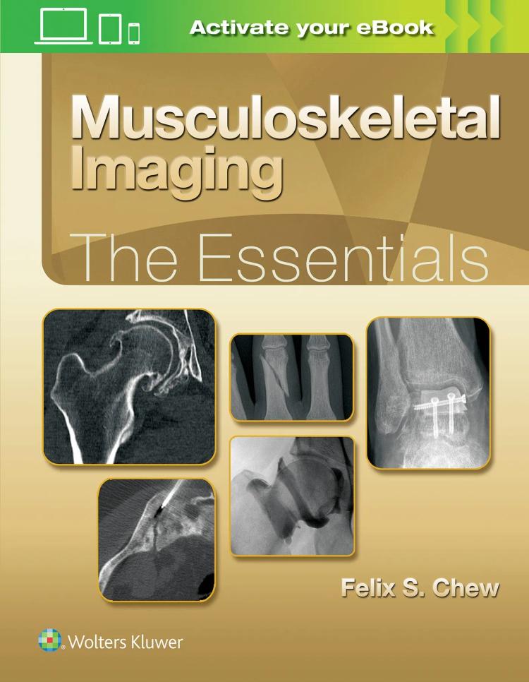 Musculoskeletal Imaging: The Essentials -1st Edition