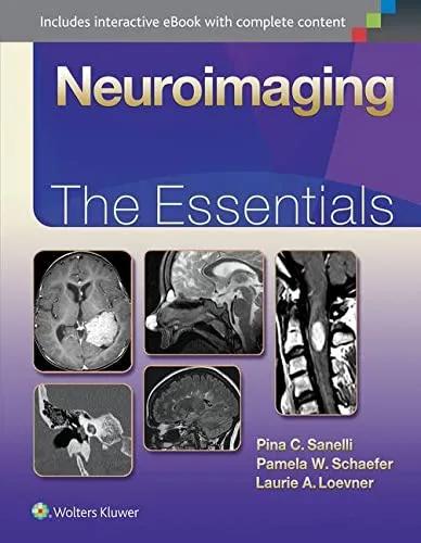 Neuroimaging - The Essentials | 1st Edition