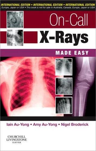 On-Call X-Rays Made Easy - 1st Edition