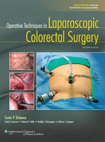 Operative Techniques in Laparoscopic Colorectal Surgery | 2nd Edition