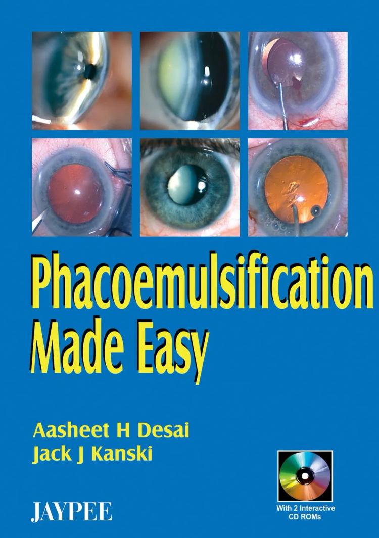 Phacoemulsification Made Easy with 2 CD Rom - 1st Edition