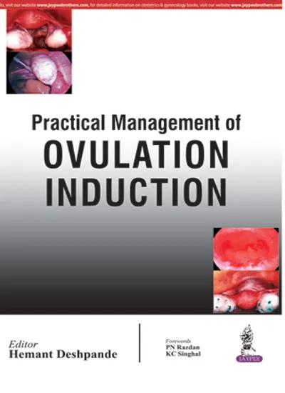 Practical Management of Ovulation Induction - 1st Edition
