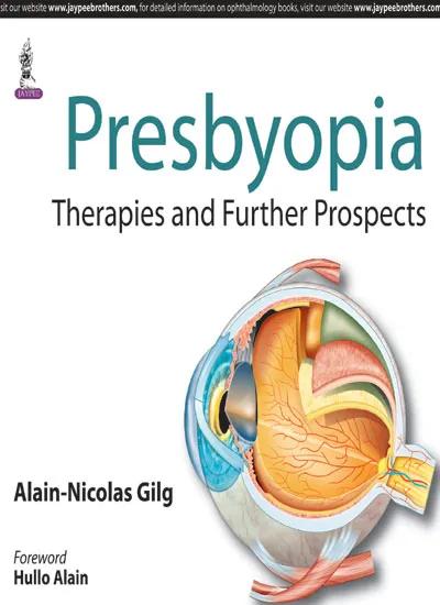 Presbyopia:therapies and Further Prospects - 1st Edition