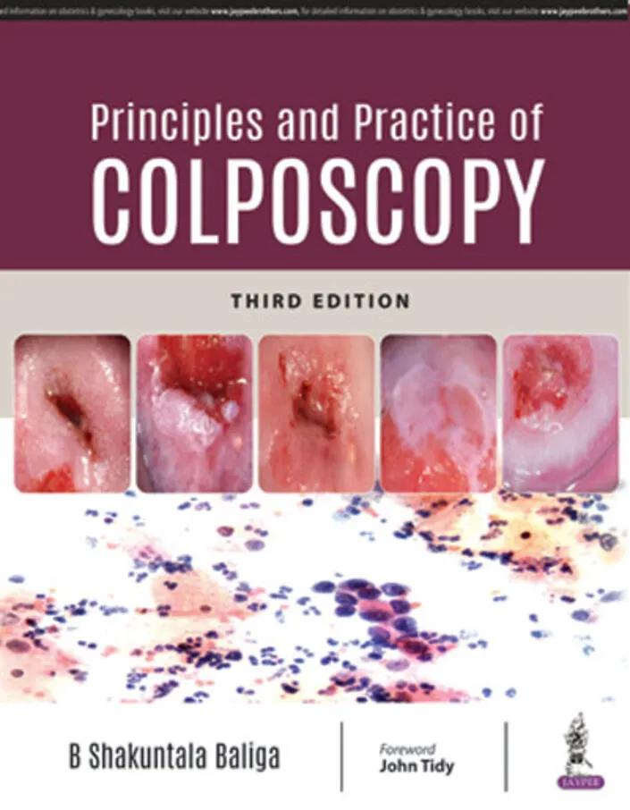 Principles And Practice Of Colposcopy