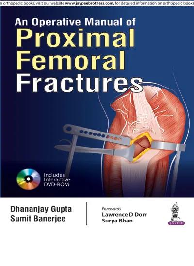 An Operative Manual of Proximal Femoral Fractures with Dvd-rom - 1st Edition