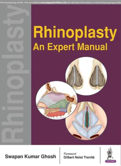 Rhinoplasty Expert Manual - 1st Edition