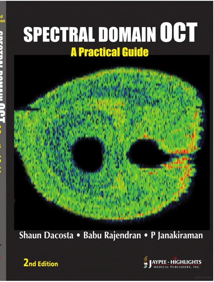 Spectral Domain Oct Practical Guide - 2nd Edition