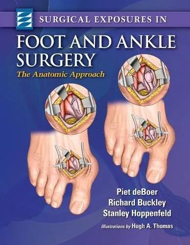 Surgical Exposures in Foot and Ankle Surgery - 1st Edition