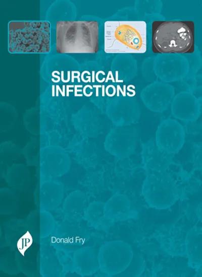 Surgical Infections - 1st Edition