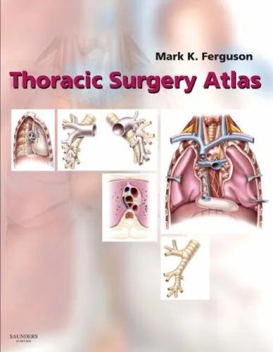 Thoracic Surgery Atlas--1E