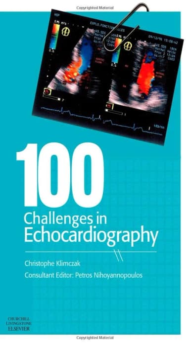 Image of - 100 Challenges in Echocardiography - 1st Edition