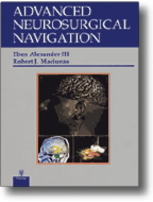 Advanced Neurosurgical Navigation - 1st Edition