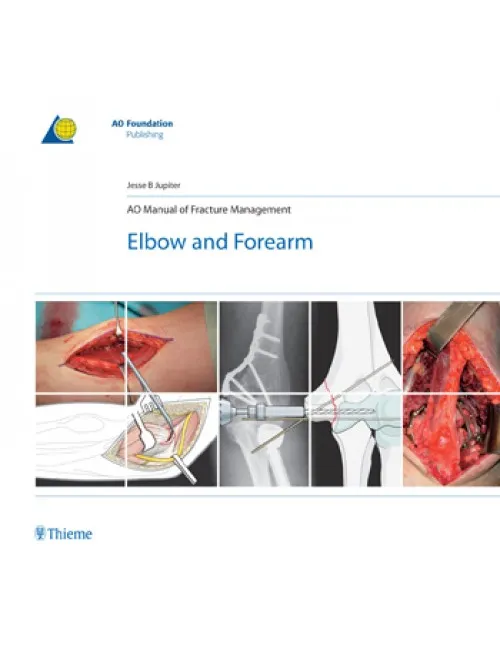 AO Manual Of Fracture Management: Elbow & Forearm - 1st Edition