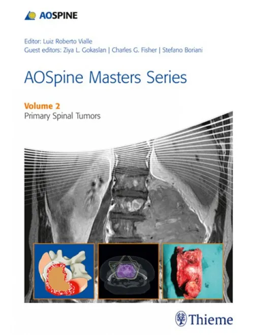 AOSpine Masters Series Volume 2 Primary Tumors - 1st Edition