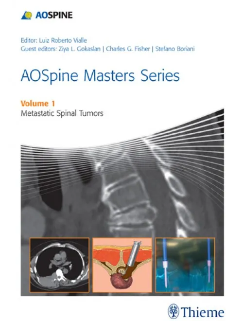 AOSpine Masters V1 Metastatic Spnl Tumors Indnprnt - 1st Edition