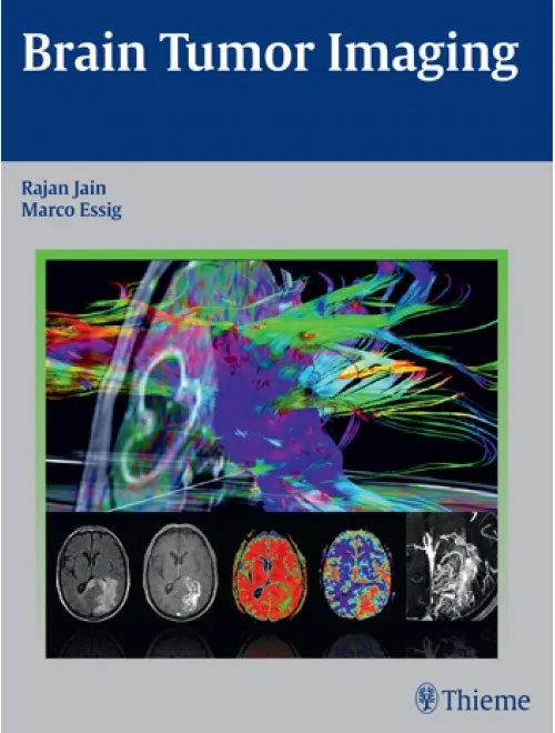 Brain Tumor Imaging - 1st Edition