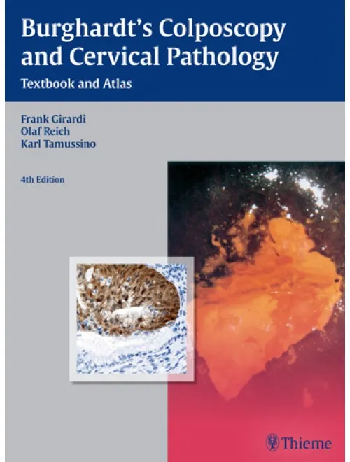 Burghardt's Colposcopy and Cervical Pathology - 4th Edition