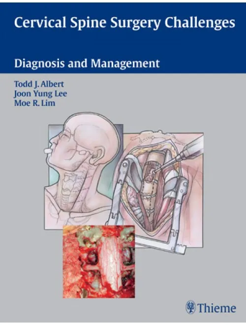 Cervical Spine Surgery Challenges - 1st Edition