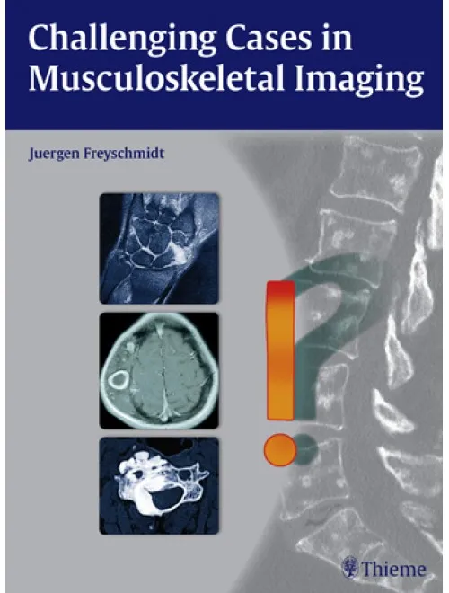 Challenging Cases in Musculoskeletal Imaging - 1st Edition