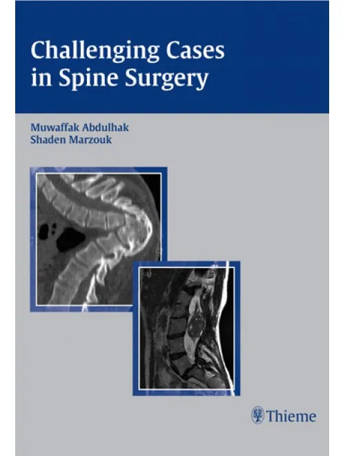 Challenging Cases in Spine Surgery - 1st Edition