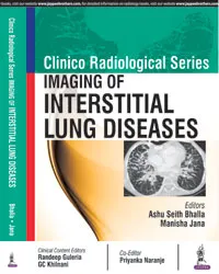 CLINICO RADIOLOGICAL SERIES:IMAGING OF INTERSTITIAL LUNG DISEASES