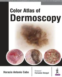 COLOR ATLAS OF DERMOSCOPY