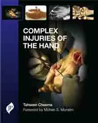 COMPLEX INJURIES OF THE HAND