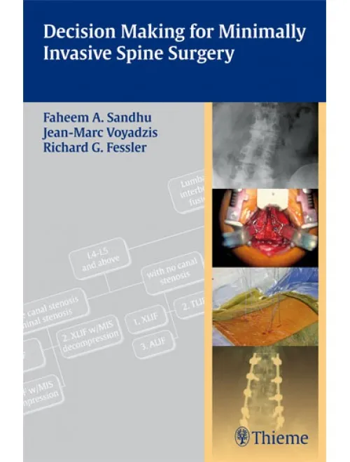 Decision Making for Minimally Invasive Spine Surge Indian Reprint - 1st Edition