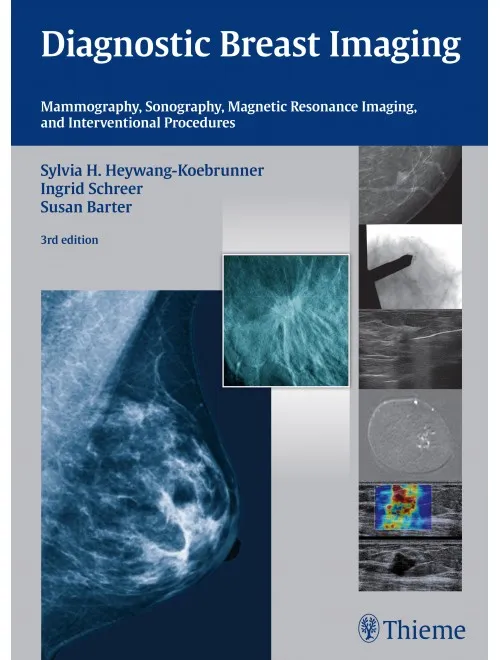 Diagnostic Breast Imaging Mammography Sonography M - 3rd Edition