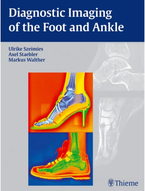 Diagnostic Imaging of the Foot and Ankle - 1st Edition