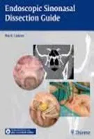 Endoscopic Sinonasal Dissection Guide - 1st Edition