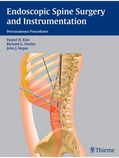 Endoscopic Spine Surgery and Instrumentation - 1st Edition