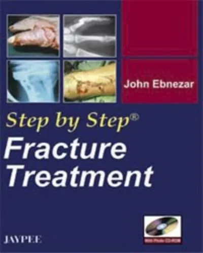 Step by Step Fracture Treatment with Photo Cd-rom - 1st Edition