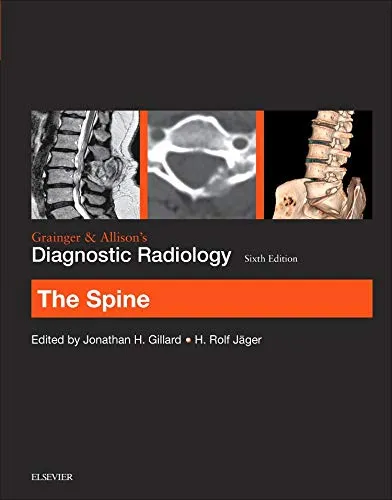 Grainger and Allisons Diagnostic Radiology The Spine - 6th Edition