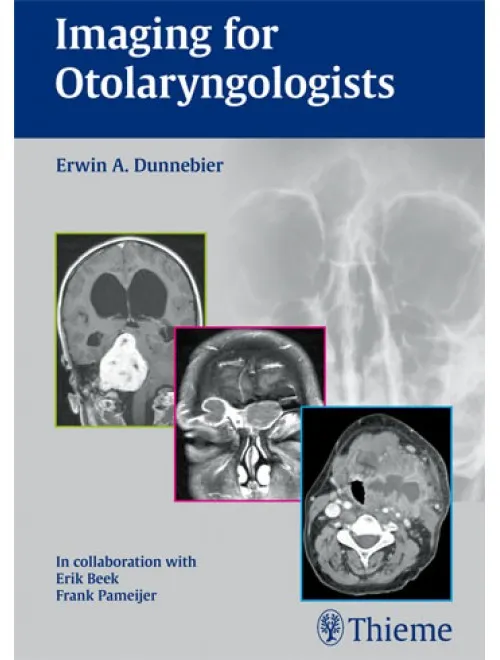 Imaging for Otolaryngologists - 1st Edition