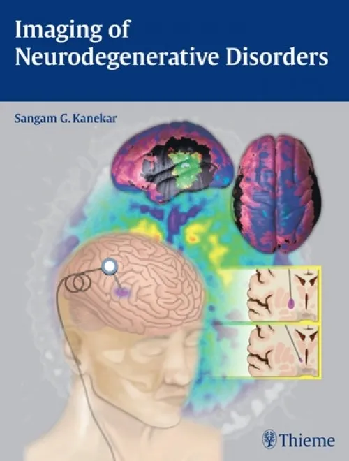 Imaging of Neurodegenerative Disorders - 1st Edition